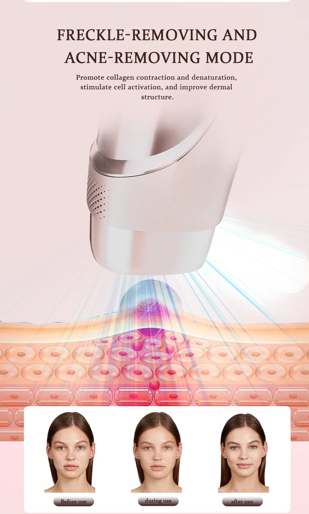 IPL Laser Epilator 7