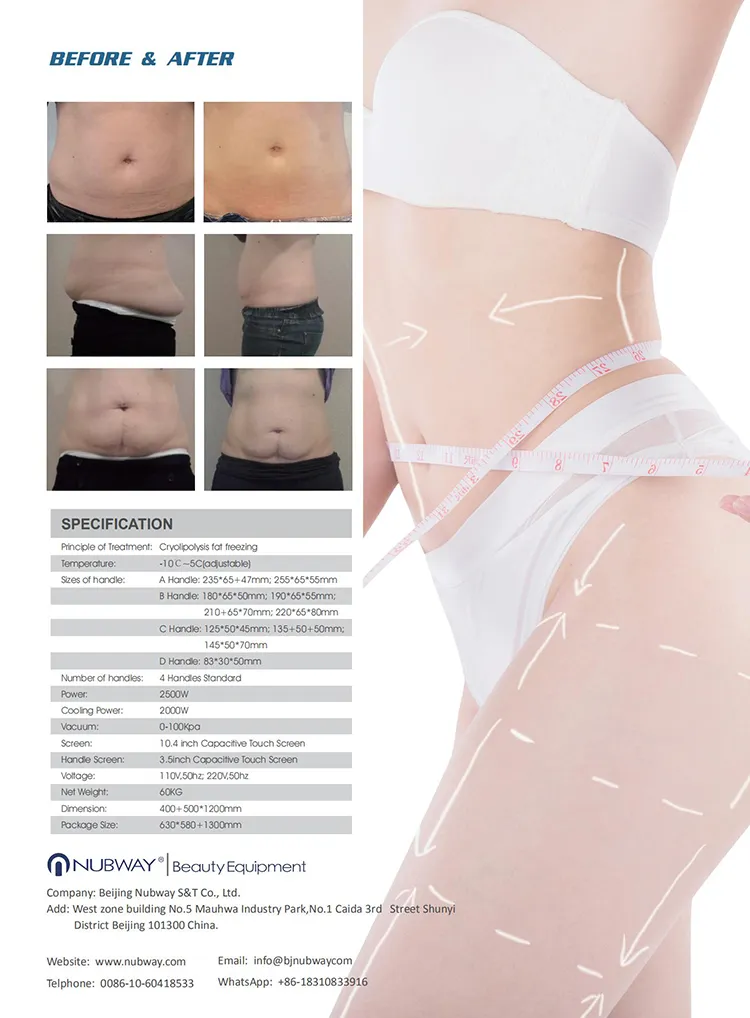 Fat Freezing Handles Tips