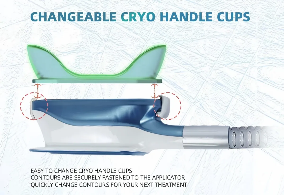 Handle Cups Detail