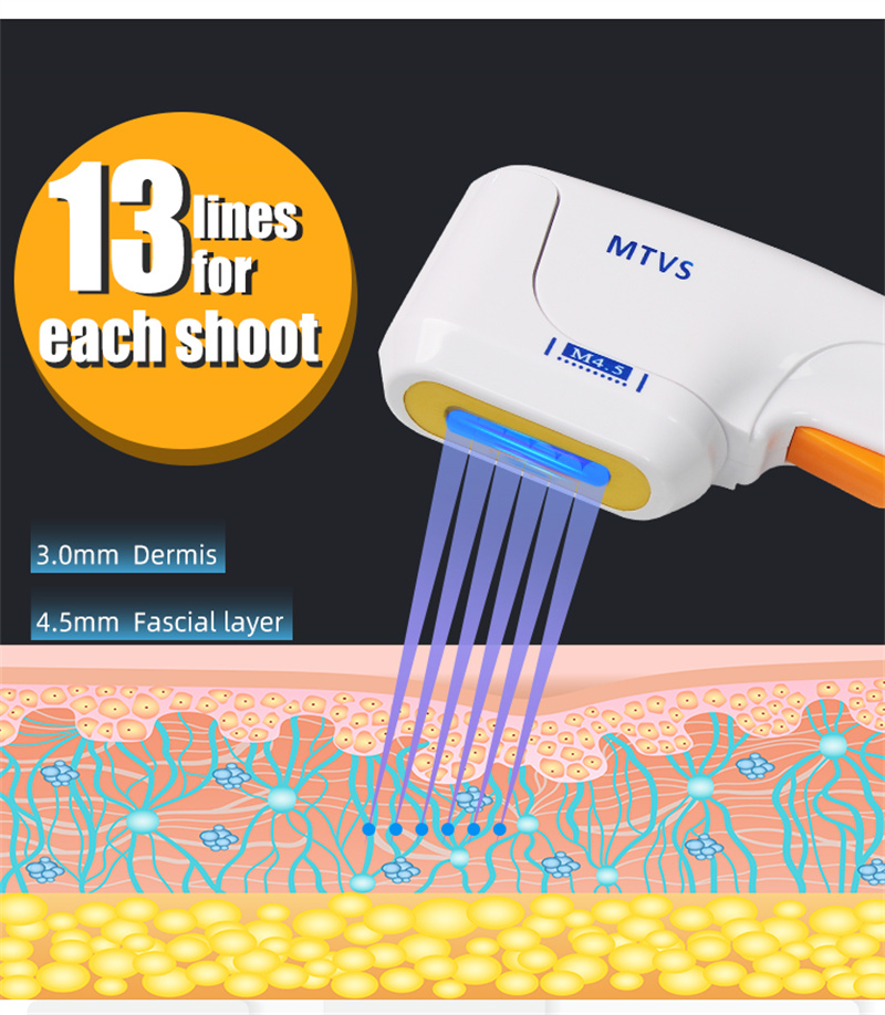 7D Hifu Machine Face Lift