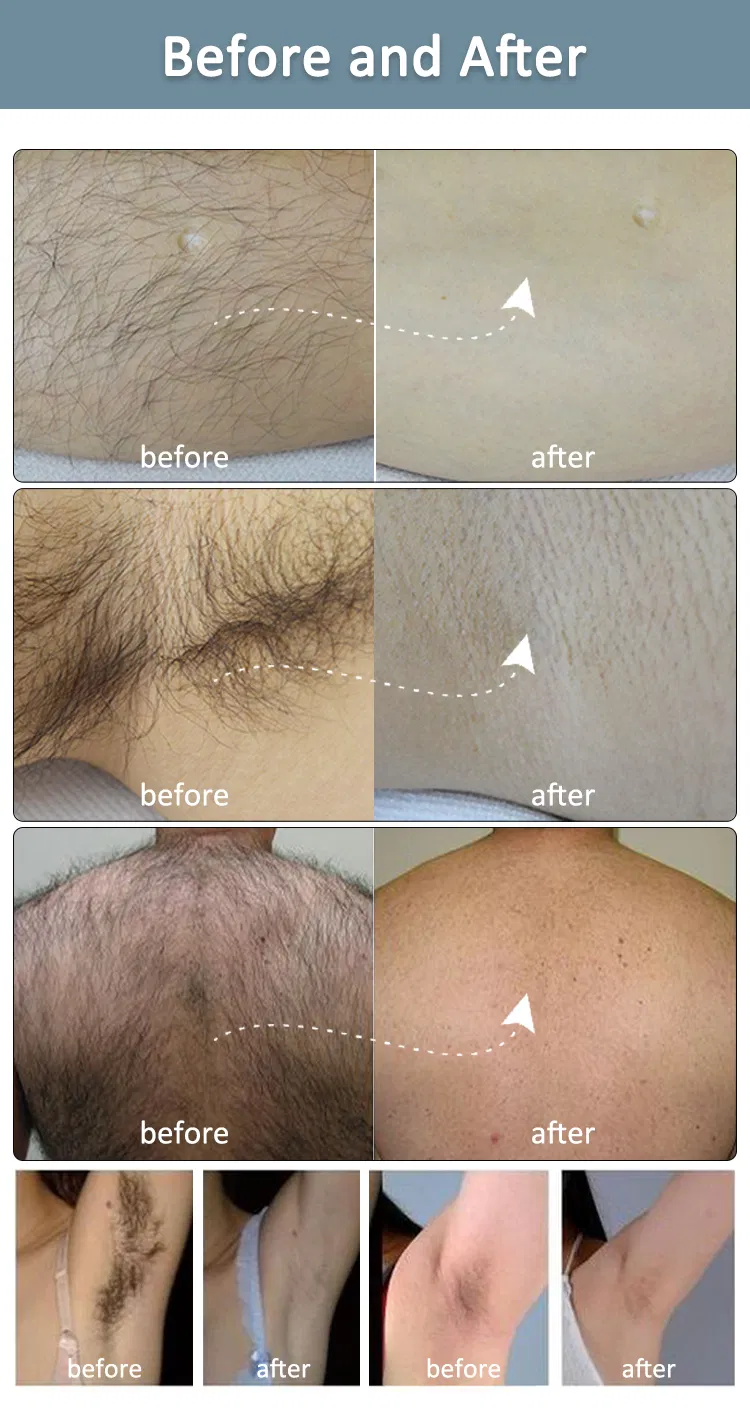 Before and After 2