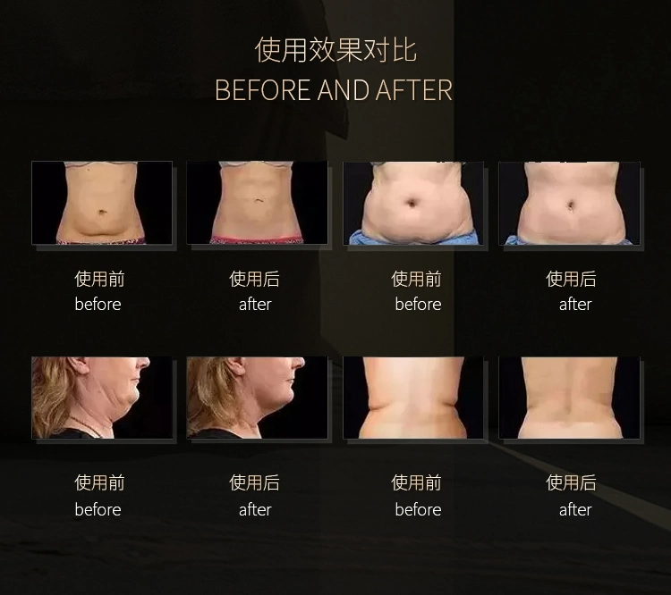 5D Body Shaping Reduction Skin Tightening Machine 40K Ultrasonic Cavitation Device Multifunction Body Slimming Machine
