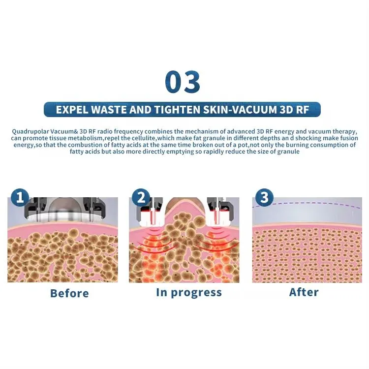 9 in 1 Lipo Laser 40K Cavitation Body Slimming Machine