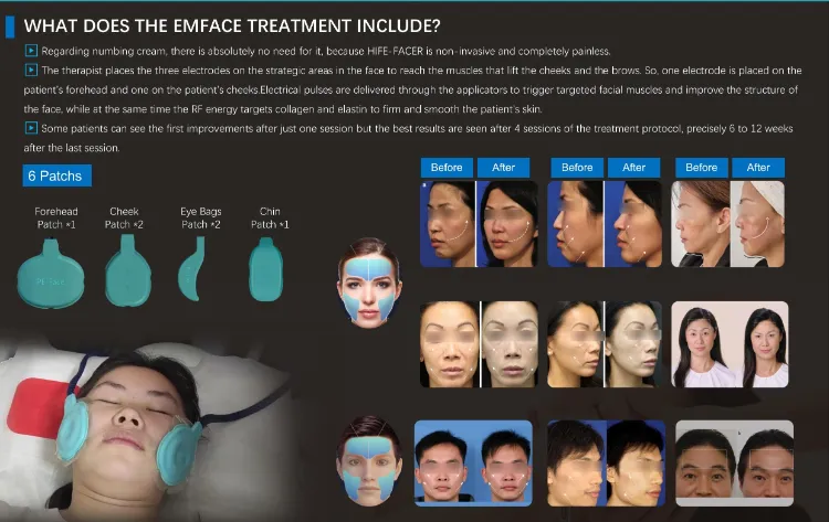 Result Comparison