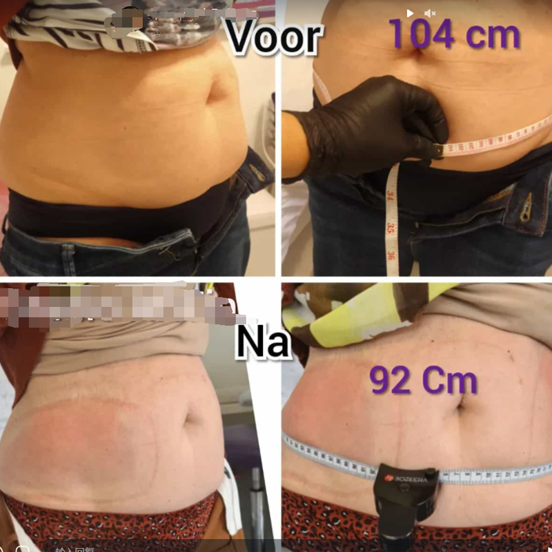 360 Cryolipolysis Cavitation RF Lipo Laser SPA Use Fat Freezing Cryolipolysis Slimming Machine