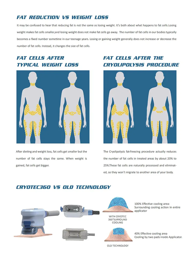 Cryolipolysis Handles Config