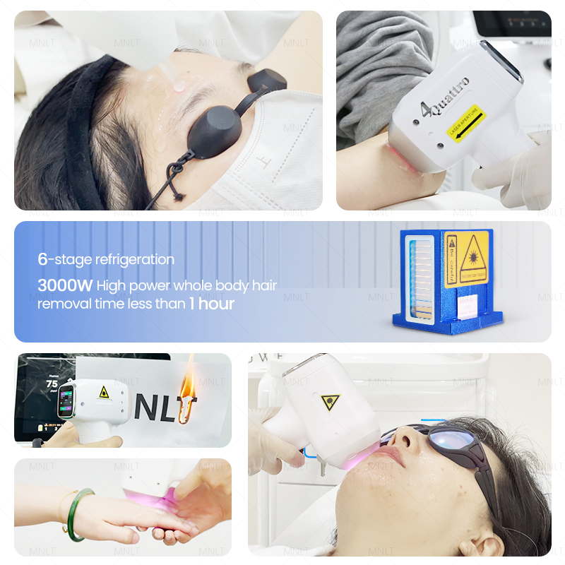 Diode Laser Titanium Factory Price Big Power 4 Waves 1064nm 940nm 755nm 808nm Hair Removal Machine