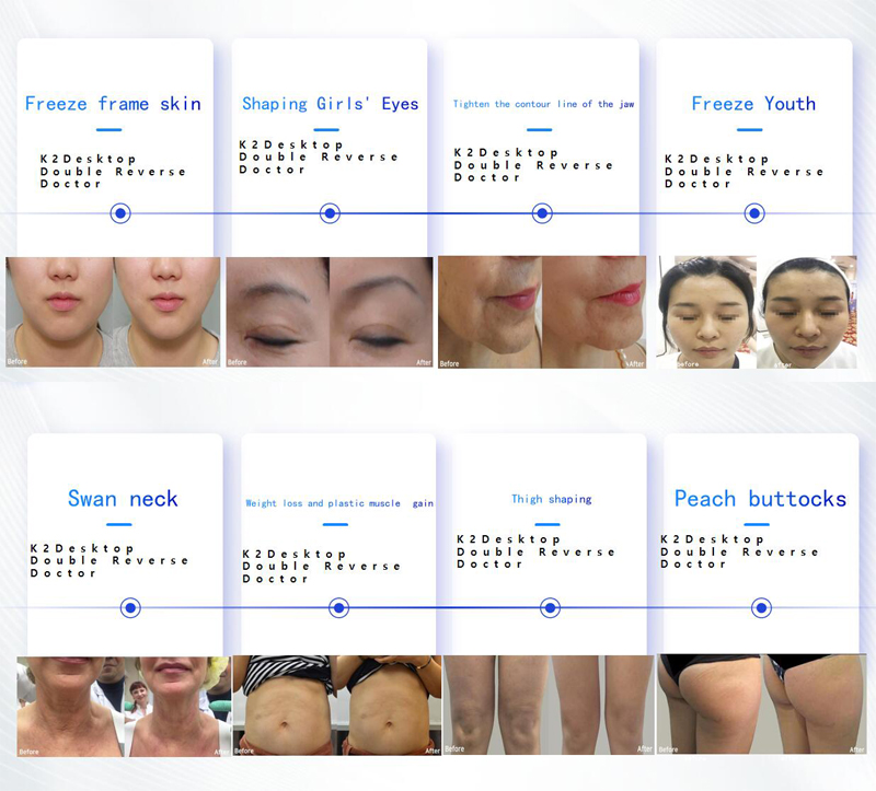 K2 Desktop Anti Aging Doctor Image 8