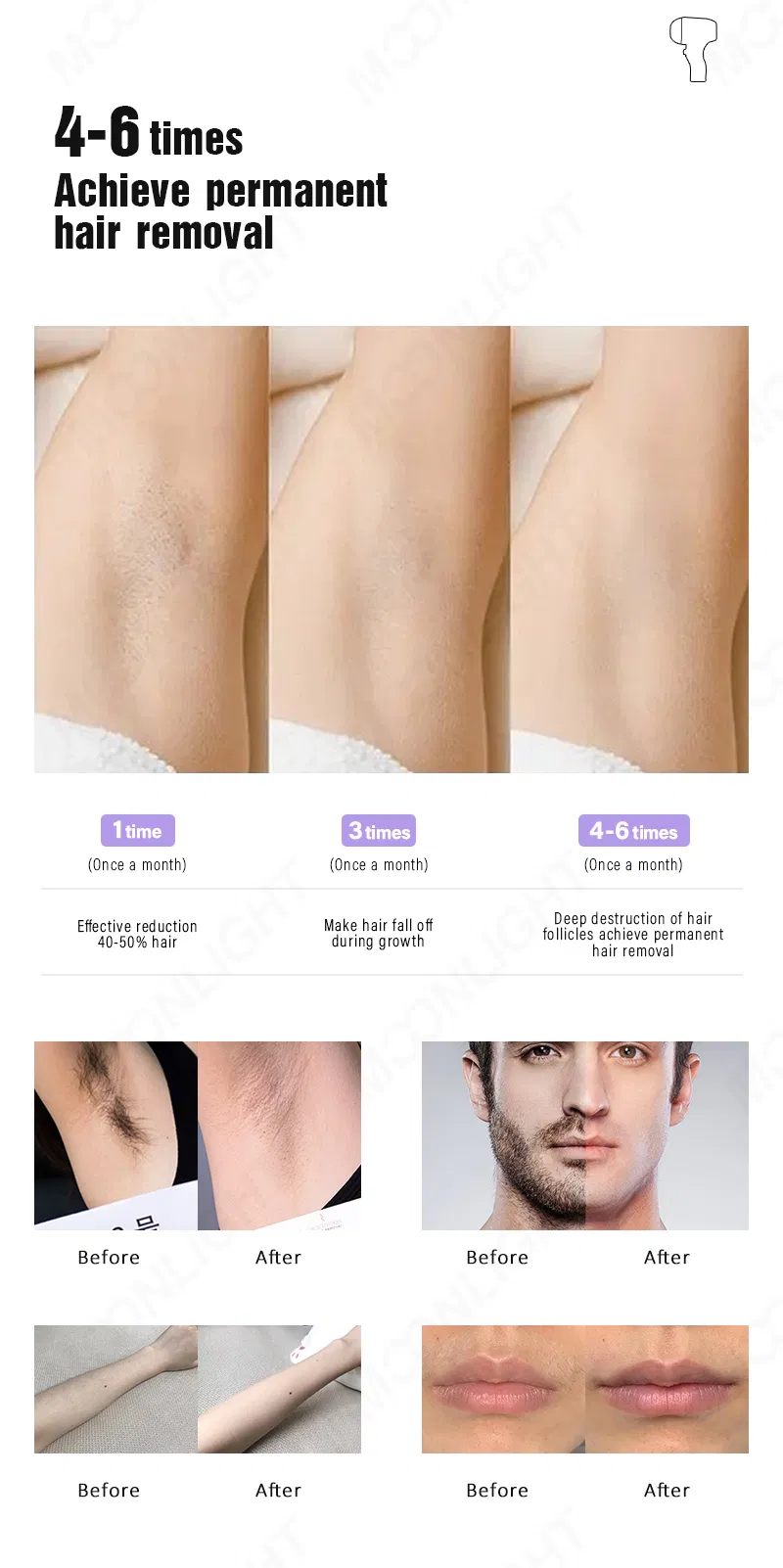 Skin Types