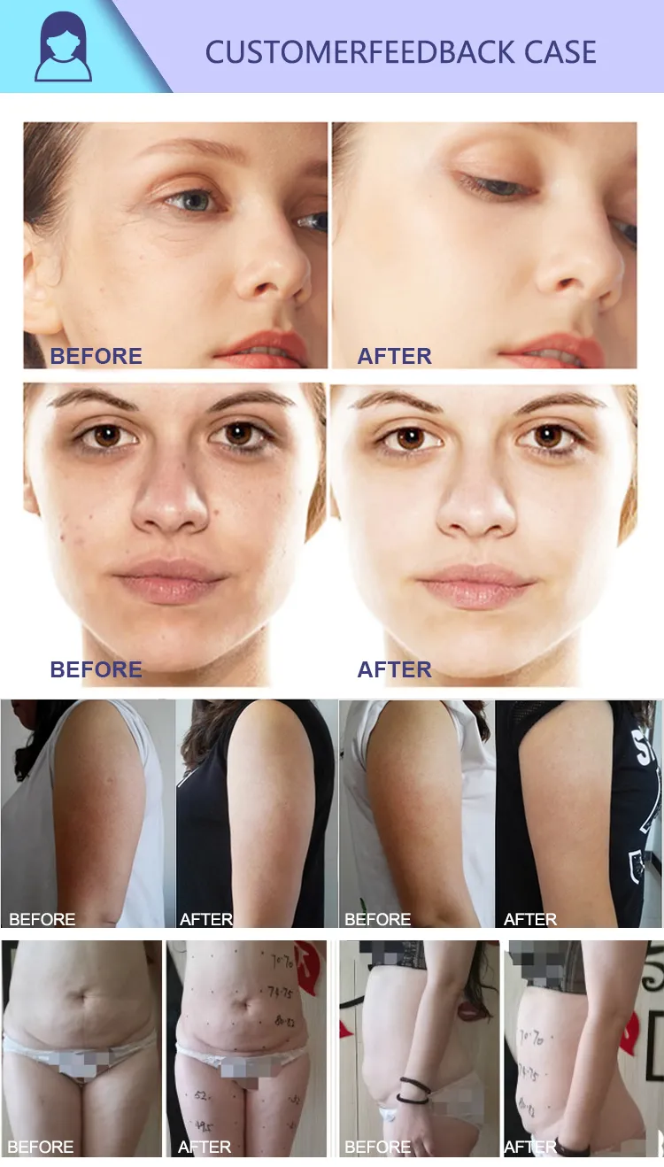 Before and After Treatment comparison 2