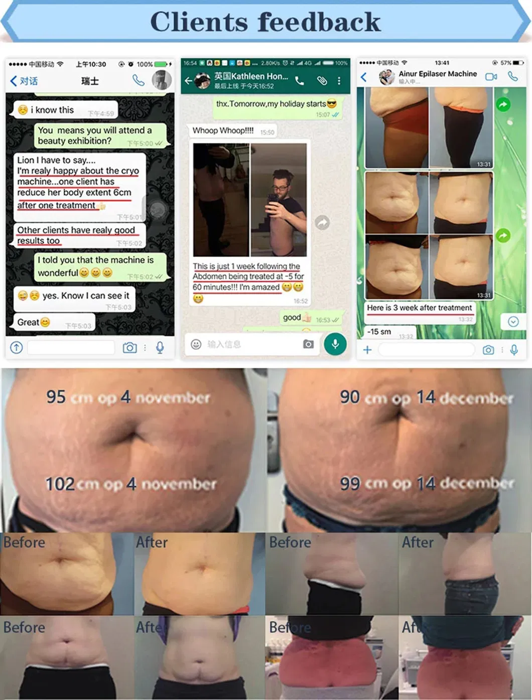 Ce Approved Beauty Machine Slimming Cool Shape Fat Freezing Slim Cryolipolysis Weight Loss Machine