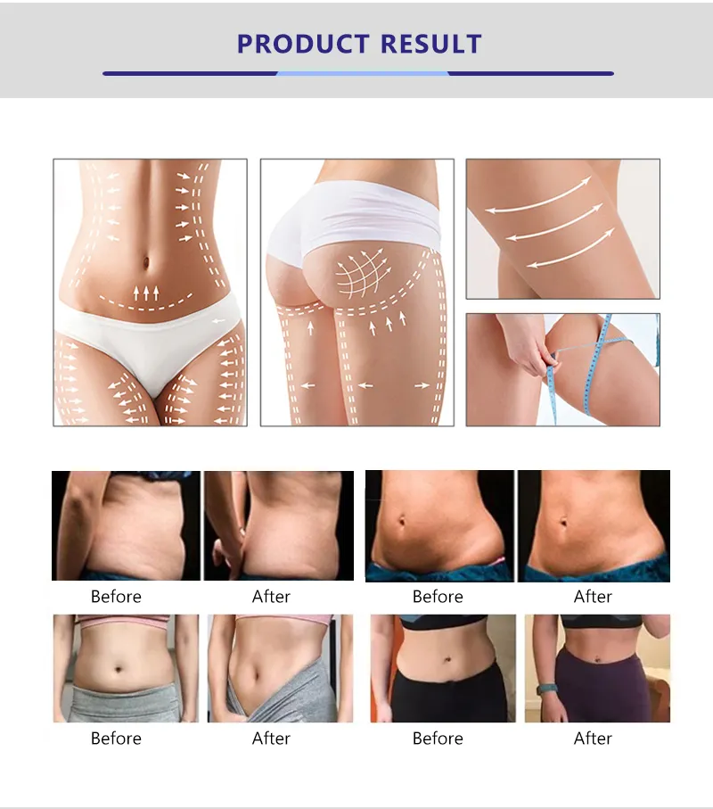 Treatment effect