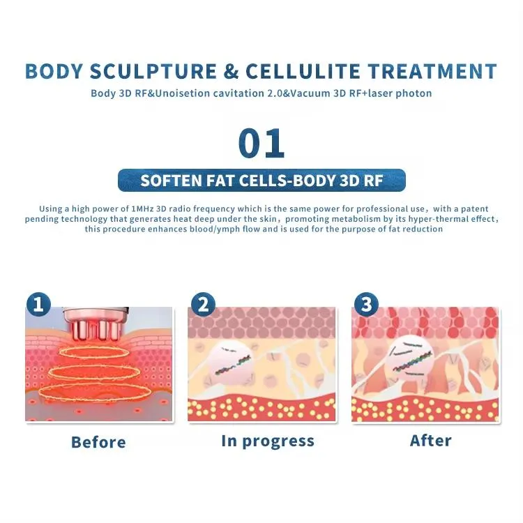 9 in 1 Lipo Laser 40K Cavitation Body Slimming Machine