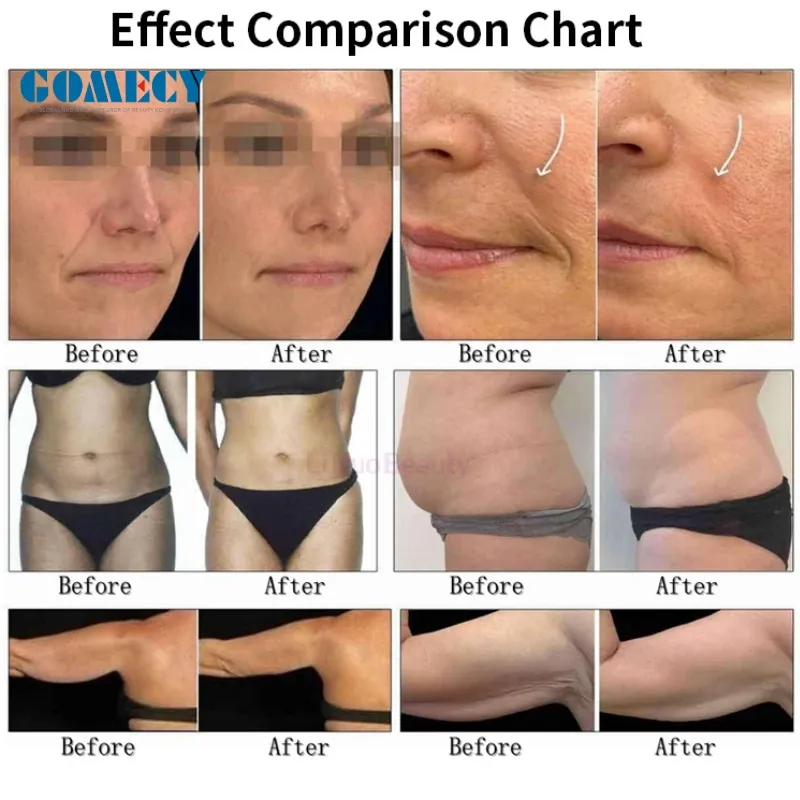 Treatment Result 3