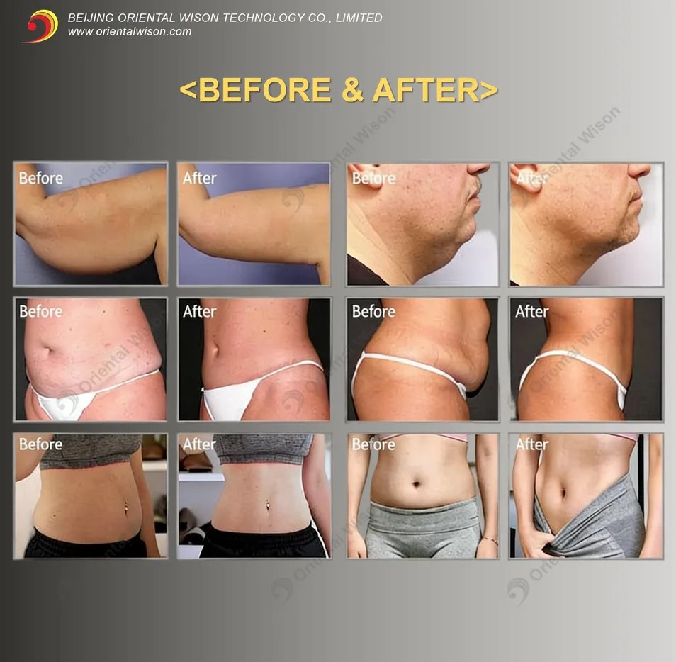 Before and After 1