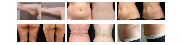 Body Management Results