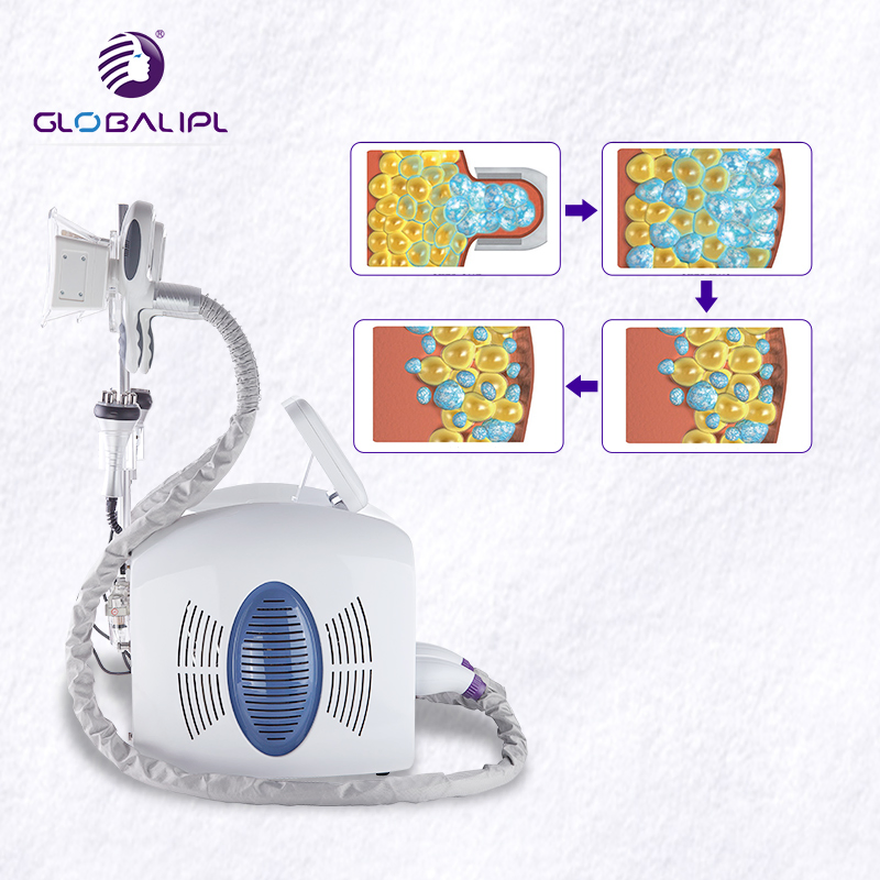 New Portable Cryolipolysis Fat Freezing Body Slimming Machine for Sale