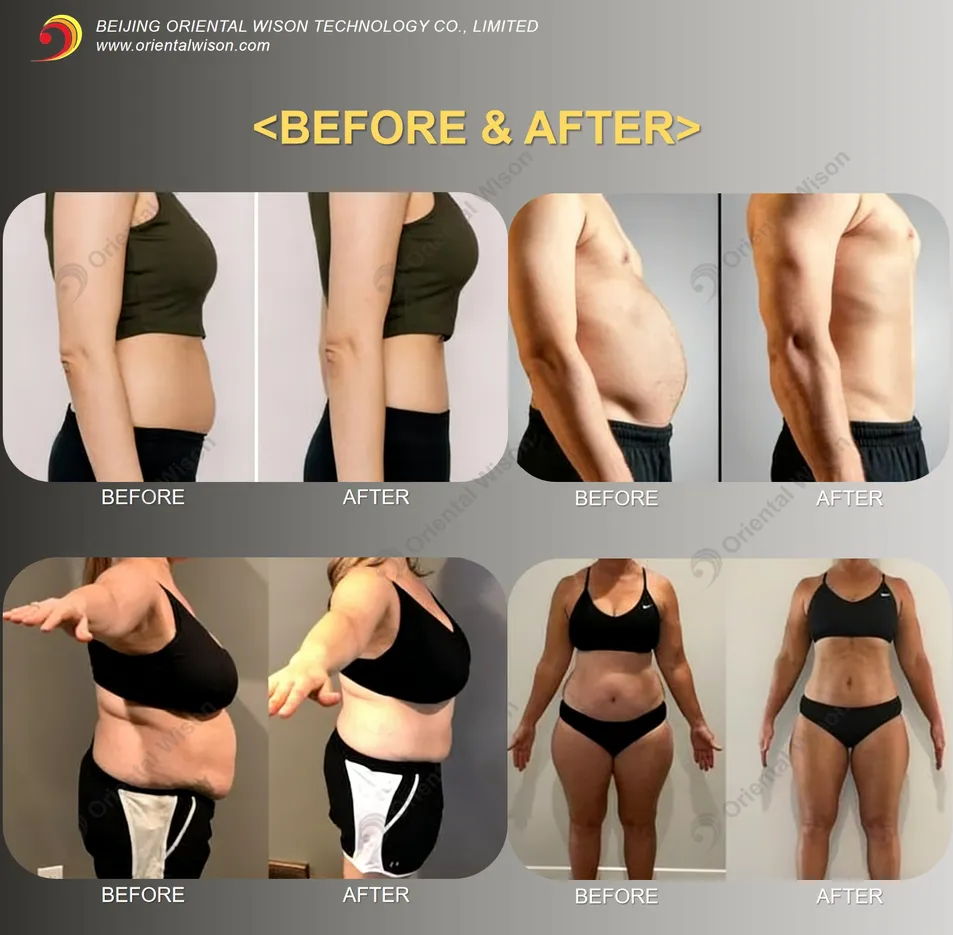 Before and After 2