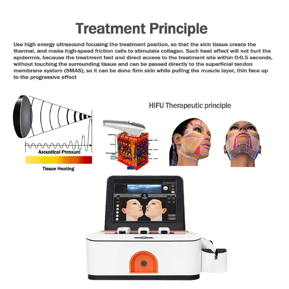High Intensity Focused Ultrasound hifu machine face lifting Anti Wrinkle Beauty Machine for Collagen Regeneration