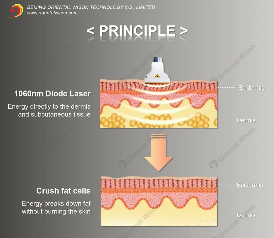 Advantages Illustration