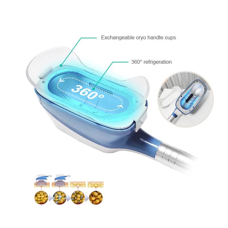 Body Slimming 360 Cryolipolysis Slimming Fat Freezing Machine