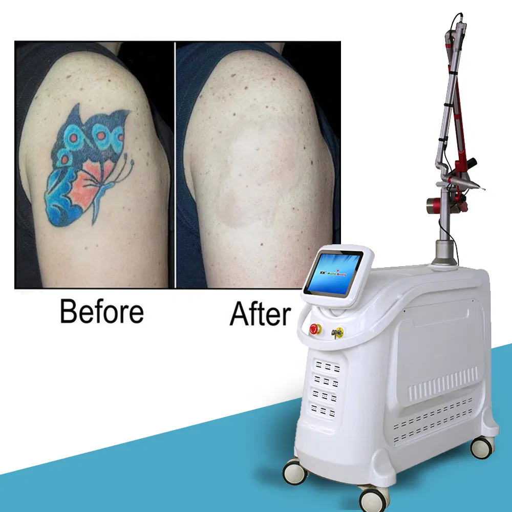 Double Rod Picosecond Laser