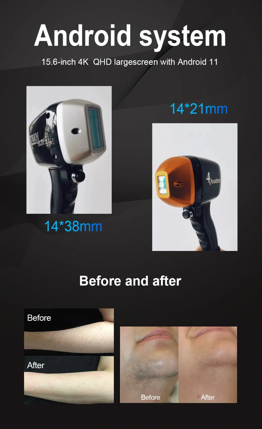 Diode Laser Handpiece Details