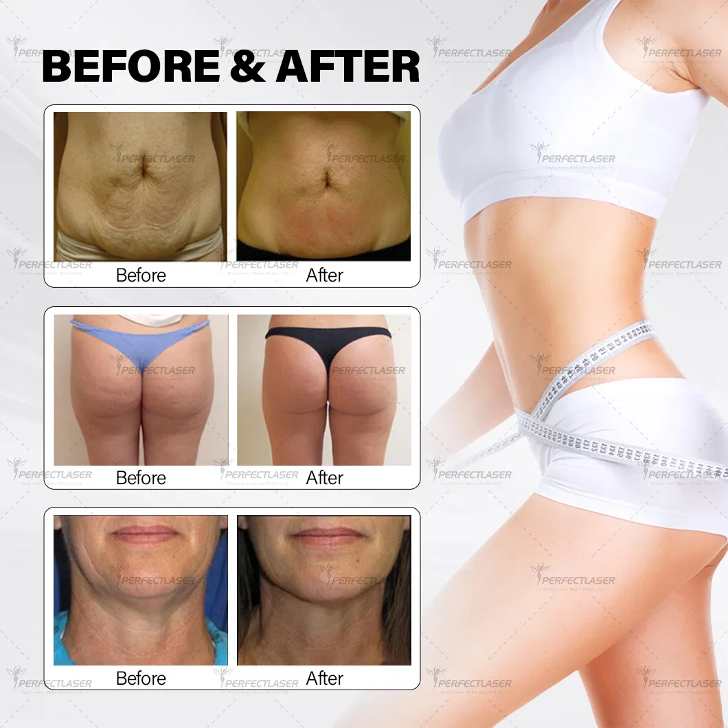 Before and After Results