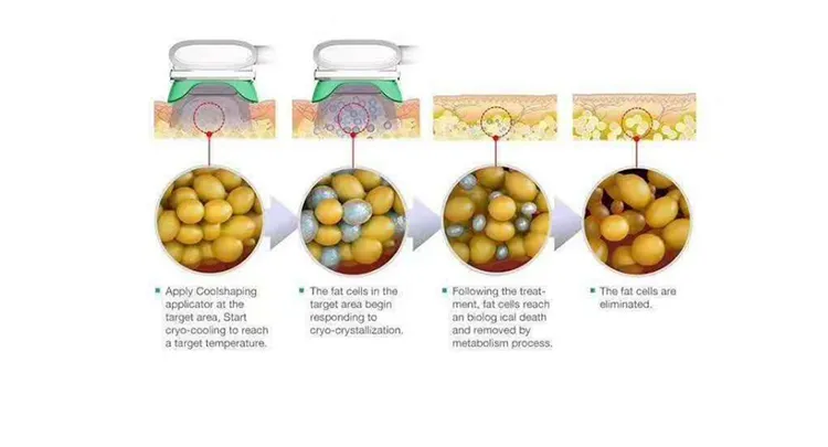 Treatment 4