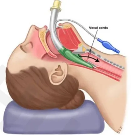 Silicone Smooth Cuff