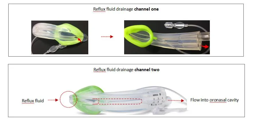 Safety Silicone Laryngeal Mask