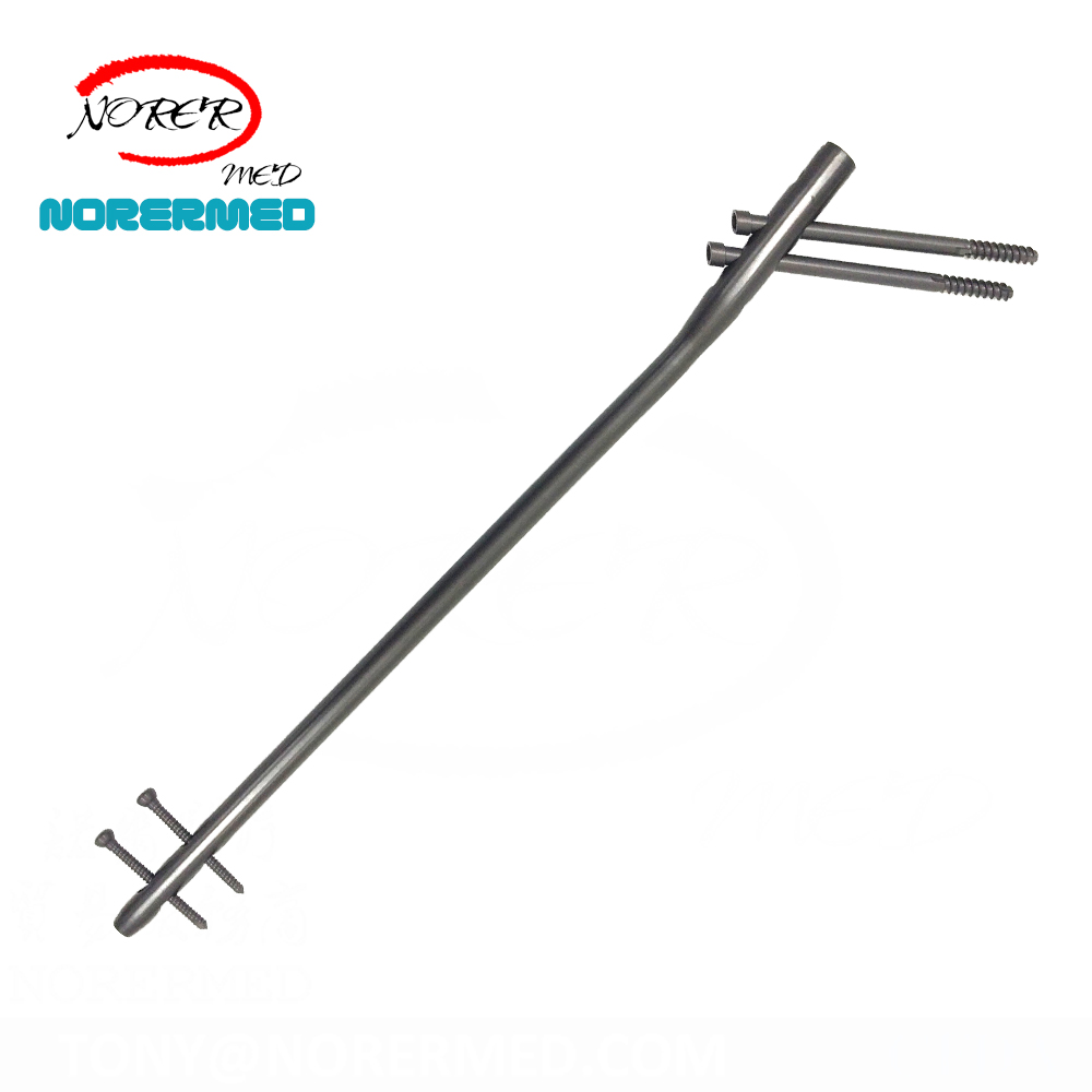 Chinese   Medical Orthopedic  Intramedullary Expert Femur Reconstruction Nailing Interlocking Nail System for Femoral Neck Fixat