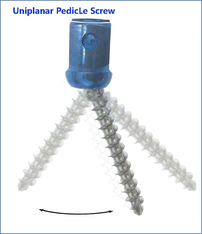 Human /Veterinary Orthopedic Titanium Spine Uniplanar Pedicle Poly Screw for Fixation