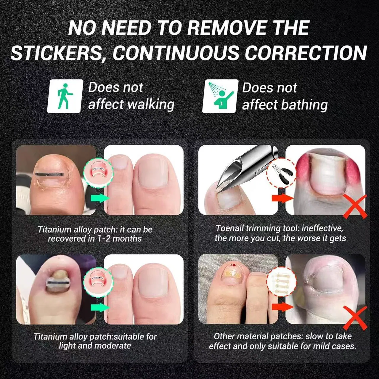 Toenail Treatment Kit 4