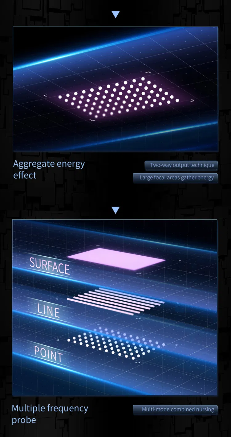 12D MAX HIFU Detail 5