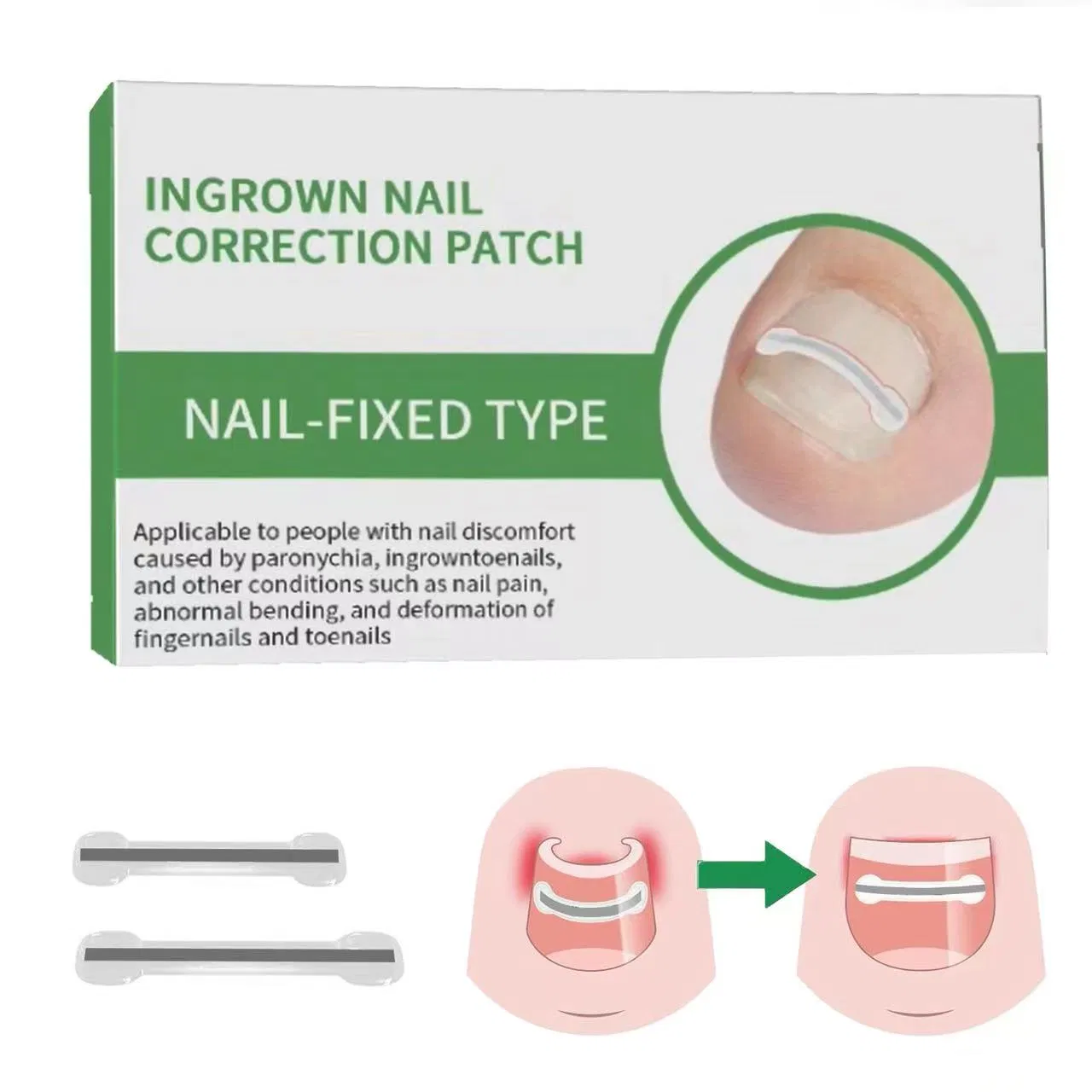 Toenail Treatment Kit 9