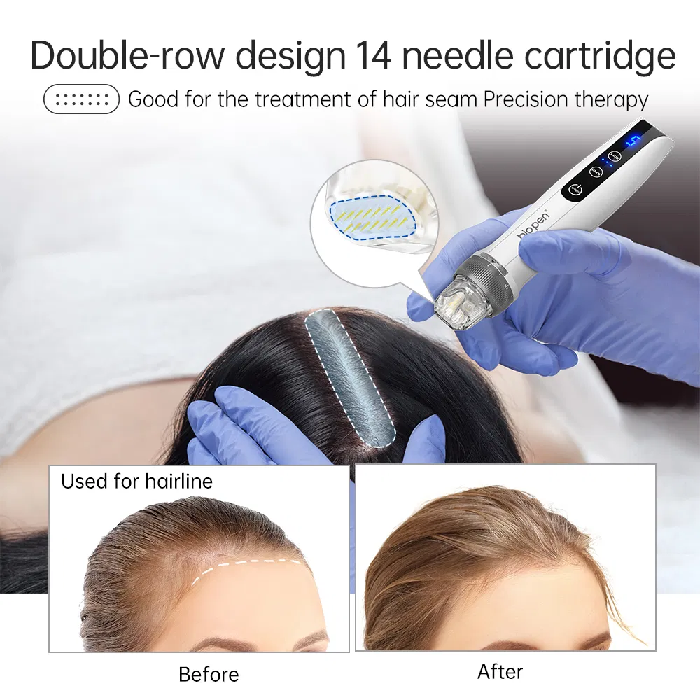 Bio Pen Q2: Professional Microneedle Tool for Skin Care Treatments