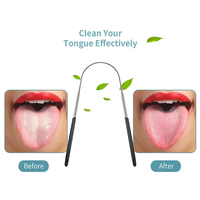 Tongue Scraper 1