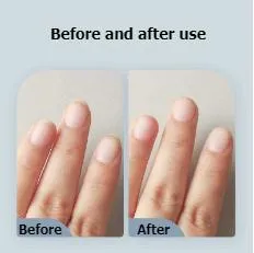 SeeMagic Electric Nail Clipper 3