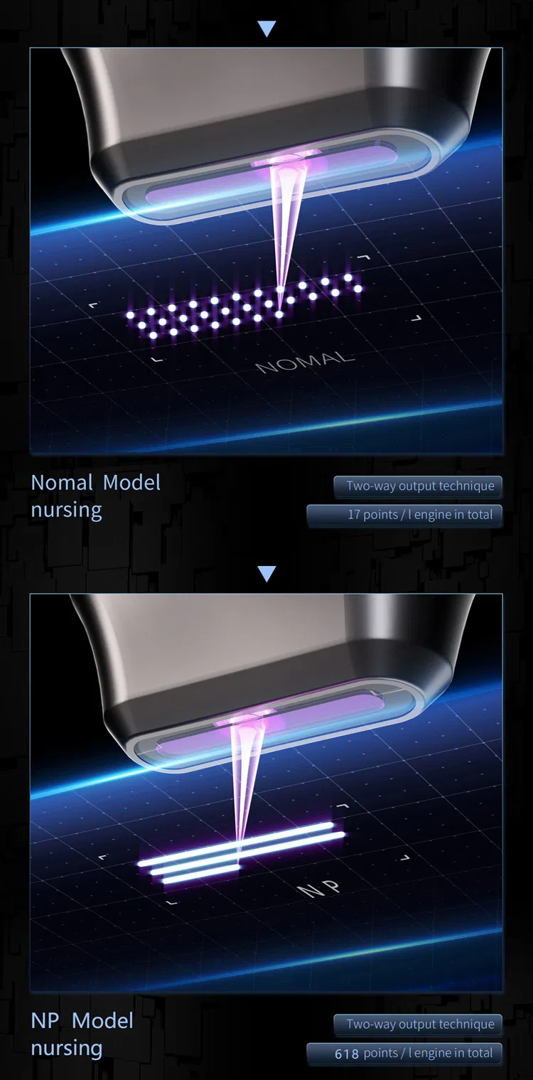 12D MAX HIFU Detail 4