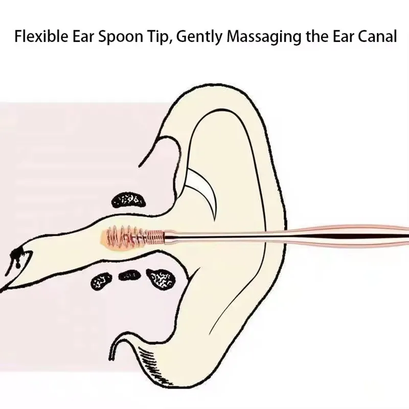 Ear Wax Removal Tool 1