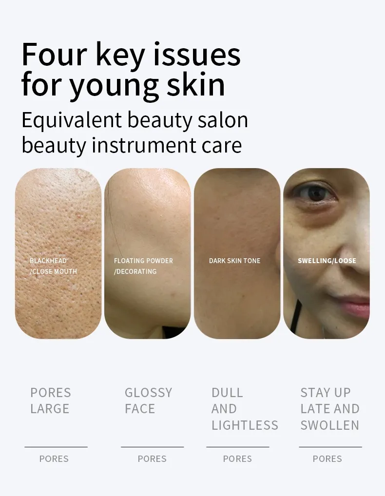 Beauty Device View 3