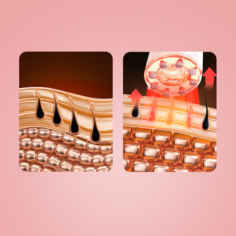 Multifunction RF EMS Facial Massage Red Light Therapy Face Lift Beauty Device