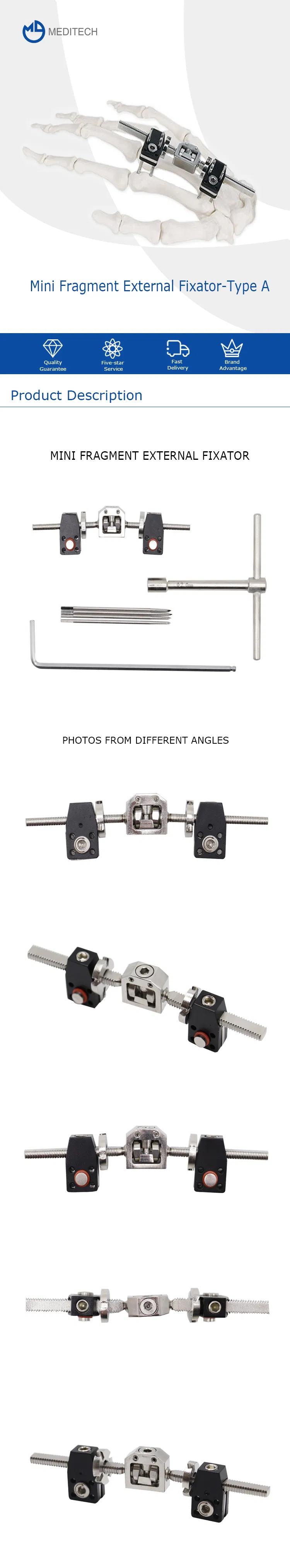 Mini Fragment External Fixator