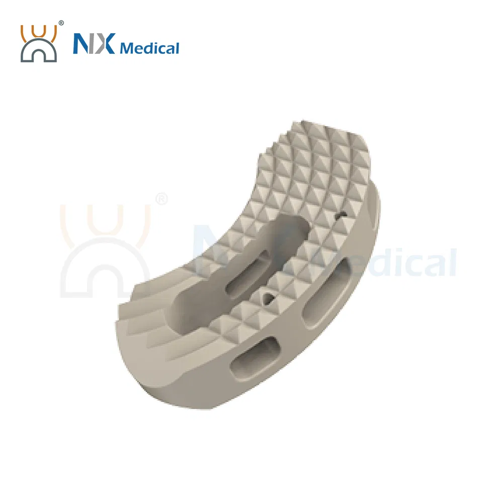 Nx Medical OEM Support Titanium Tlif Cage Peek for Posterior Lumbar Interbody Fusion