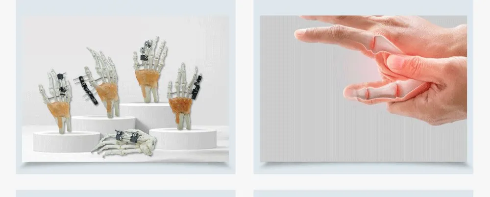 Advantages Comparison