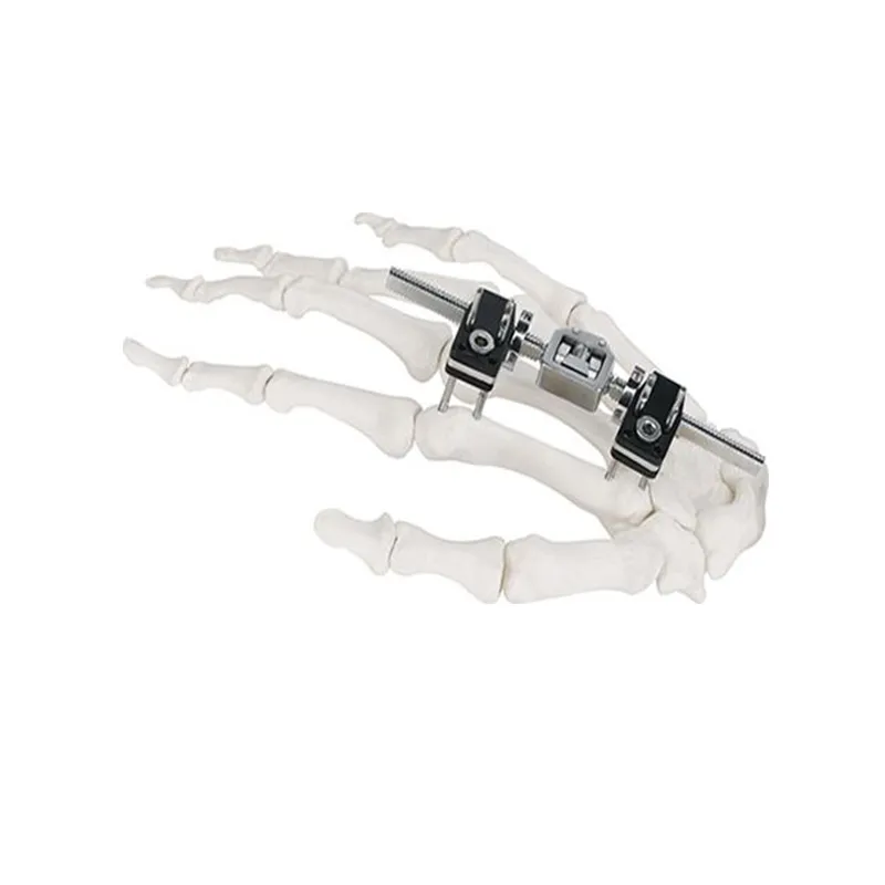 Mini External Fixator Joint Motion Type