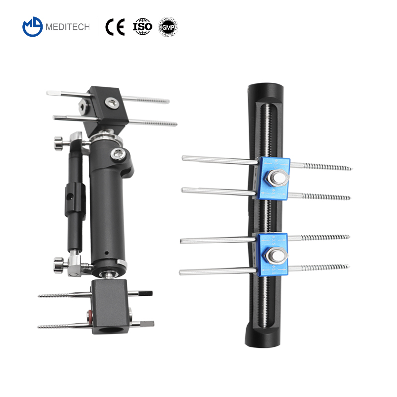 Quality Assured Orthopedic Surgical Instruments Wrist Joints External Fixator for Fracture Surgery