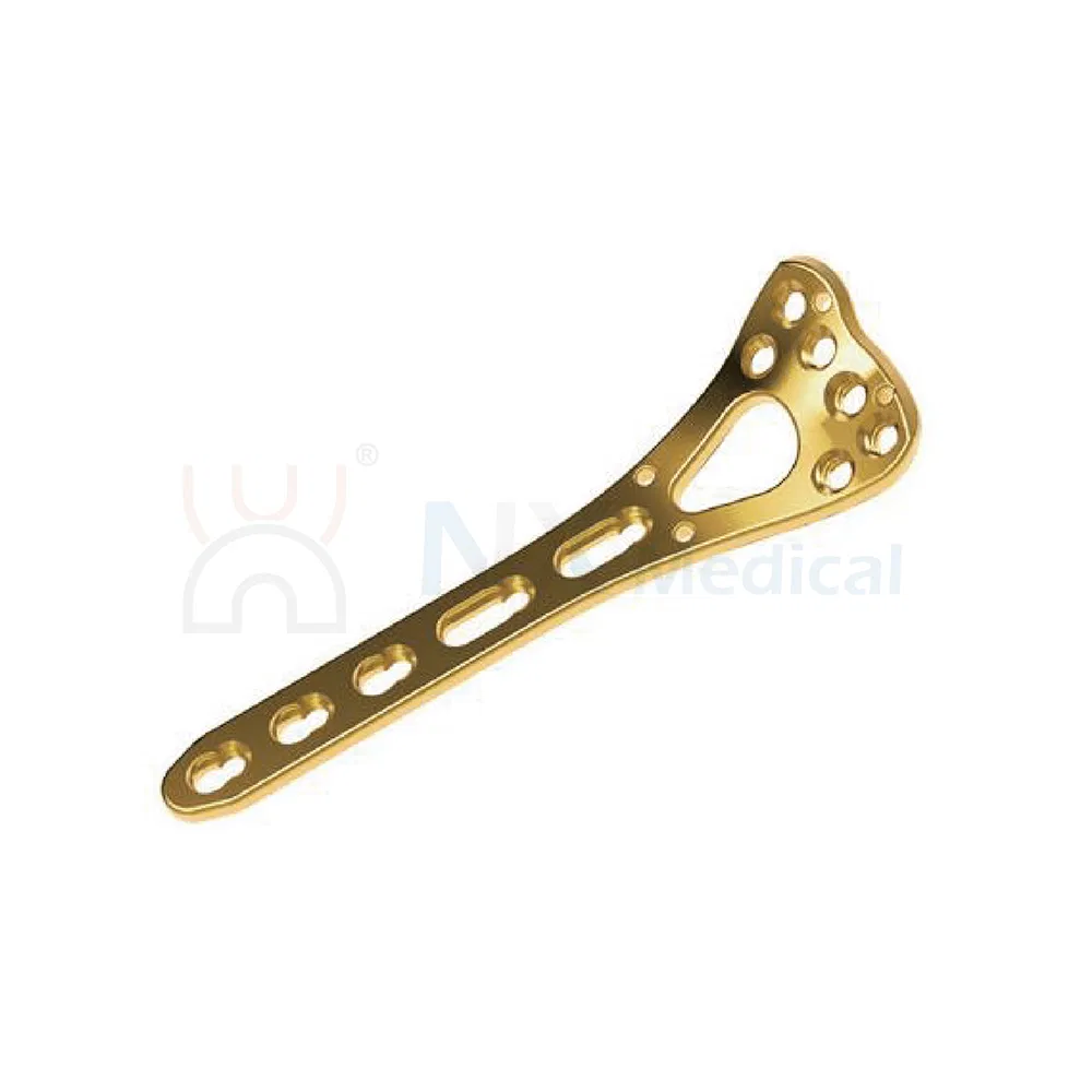 Nx Medical Variable Angle LCP Plate Radius Fragment Locking Mechanism System
