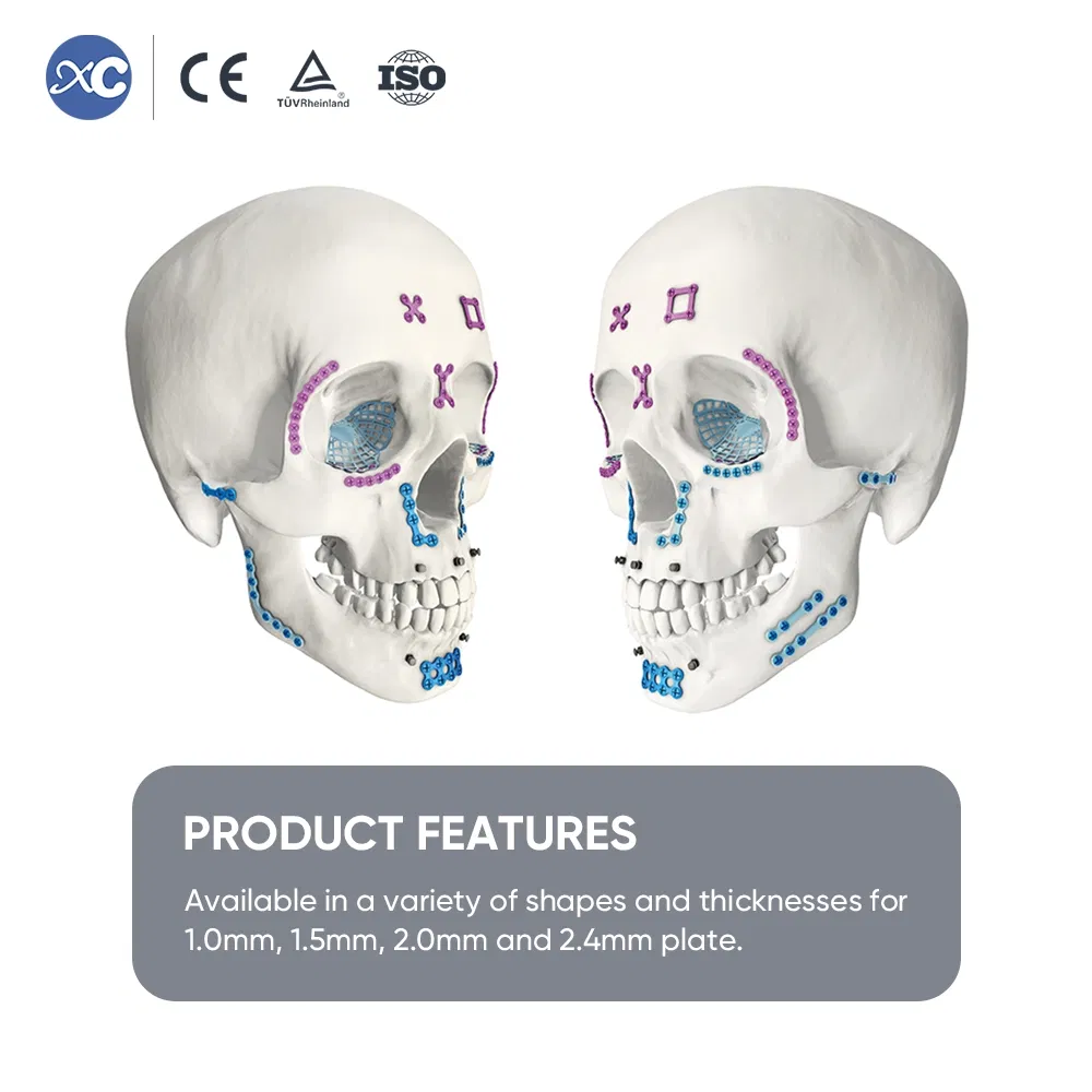 Orthopedic Titanium Maxillofacial Internalfixation System 1.5mm/2.0mm Titanium Maxillofacial Plate Implant